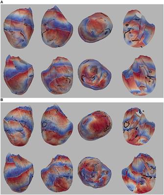 Effect of Heart Structure on Ventricular Fibrillation in the Rabbit: A Simulation Study